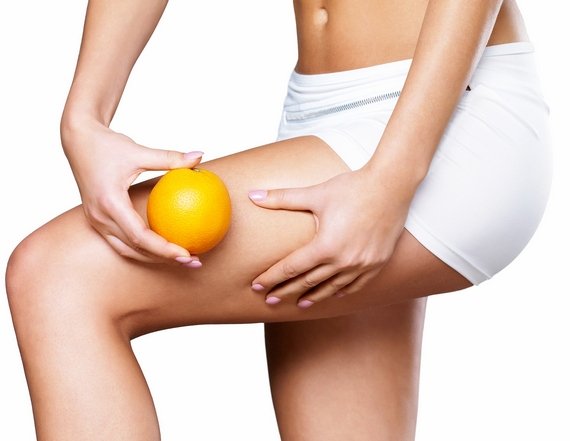 About Cellulite